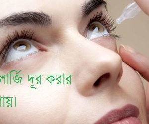 চোখের এলার্জি
